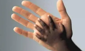 integració 