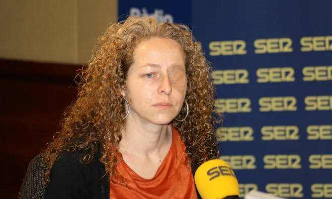 Ester Quintana, veïna de Barcelona que va perdre un ull per l'impacte d'una pilota de goma llençada pels Mossos d'Esquadra. Font: Cadena Ser