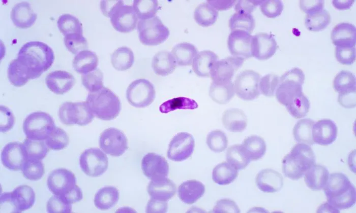Paràsit Plasmodium, causant de la malària.