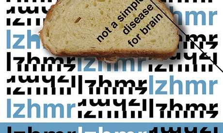Alzheimer Poster. Font: Paolo Comparin (Flickr)