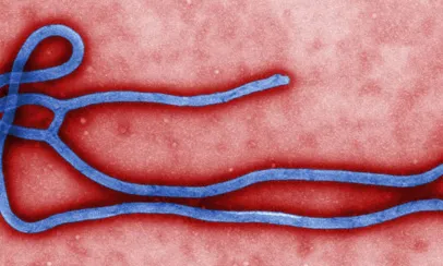 Una imatge del virus Ebola