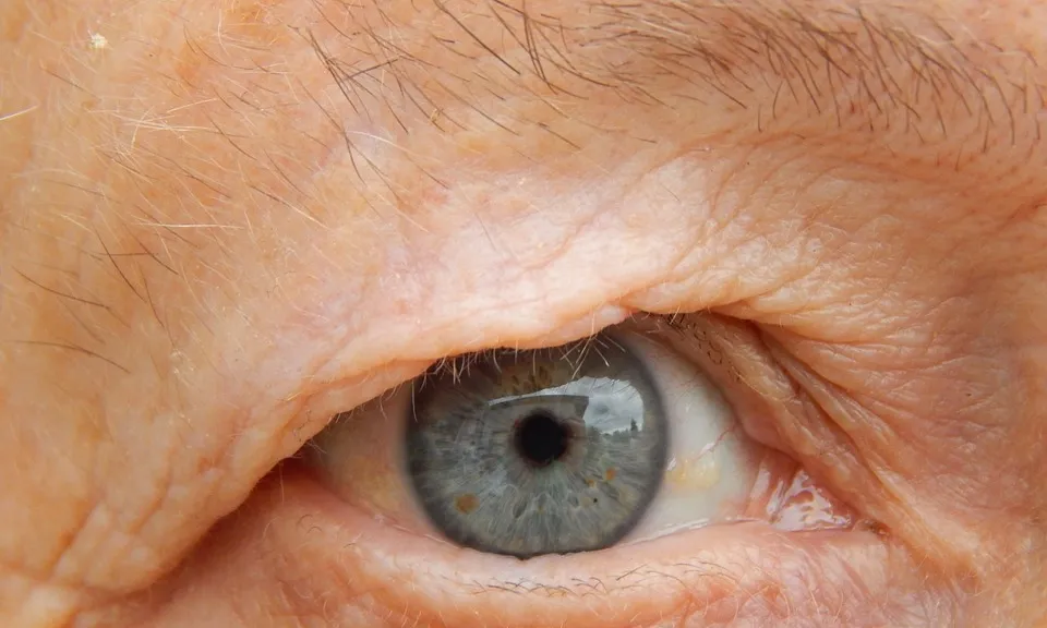 L'ull d'una àvia, que al projecte representa la mirada d'aquest col·lectiu