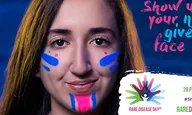 Mirina, afectada del síndrome Ehlers-Danlos 