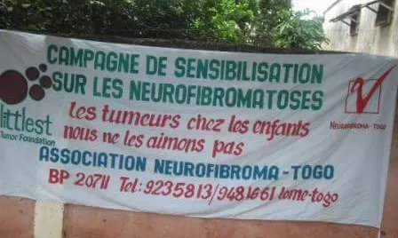 pancarta pel Dia de les Malalties rares a Togo