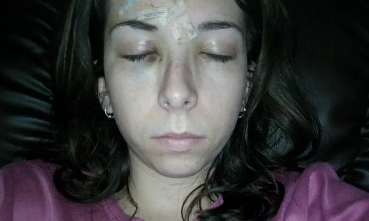 Una usuària de Viomapp mostra a Twitter l'agressió que va patir en una discoteca