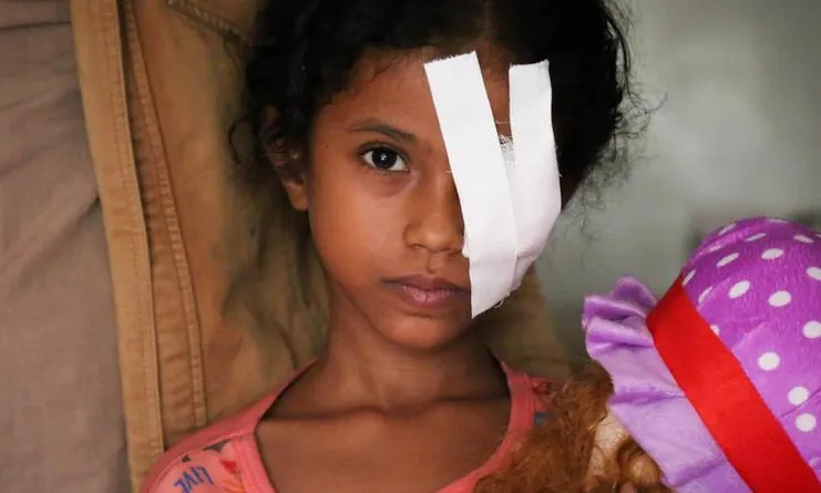 Noia jove amb una ferida a l'ull causada pel conflicte