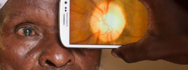 Amb un telèfon mòbil, es pot fer una anàlisi ocular. Foto MWC Font: 