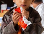 Un nen amb desnutrició al Iemen amb un aliment terapèutic llest pel seu consum. Font: Unicef/Anwar Al-Haj