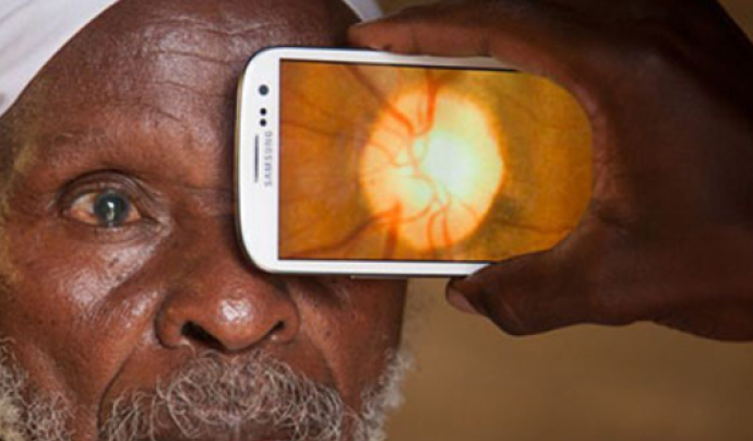 Amb un telèfon mòbil, es pot fer una anàlisi ocular. Foto MWC Font: 