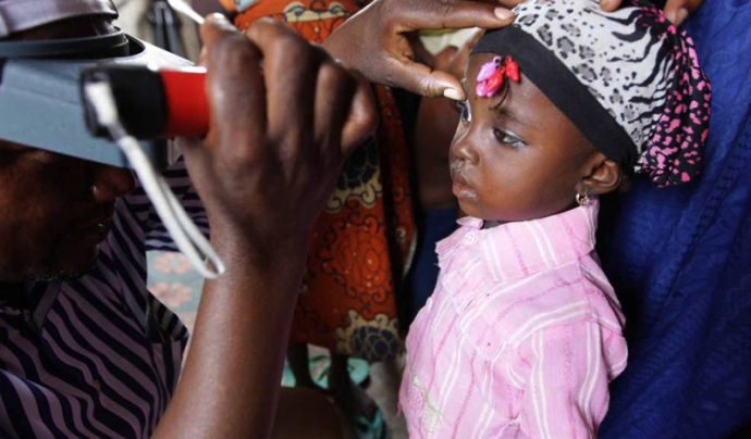 Les patologies oculars són un dels principals problemes de la població del Senegal. Font: Fundació Probitas