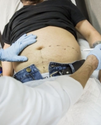 Infermer ostomaterapeuta realitza el marcatge per a una ostomia. Font: Banc d'Imatges Infermeres, Flickr